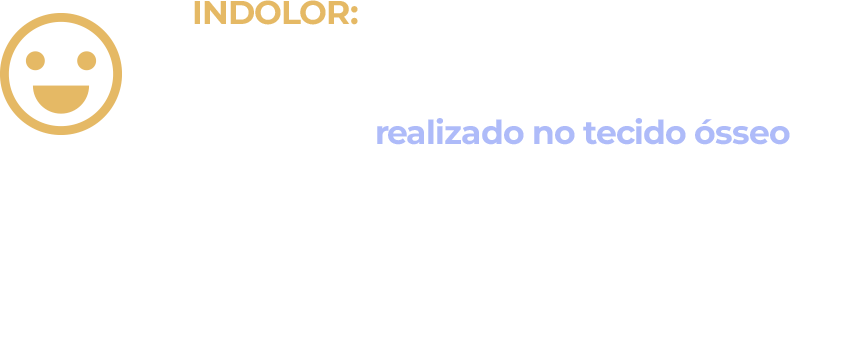 Nobrega Odontologia - Impalntes Dentários - Indolor